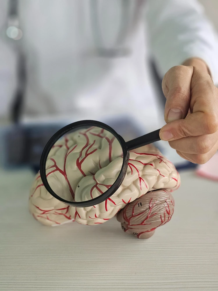 Aneurisma cerebral