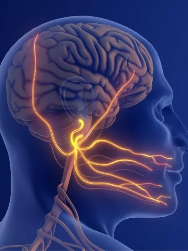 Neuralgia del trigémino